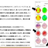2.言語発達遅延とASD